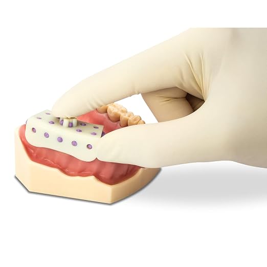 Disposable Micro-Tray Impression Trays, 50 Per Box - Image 4